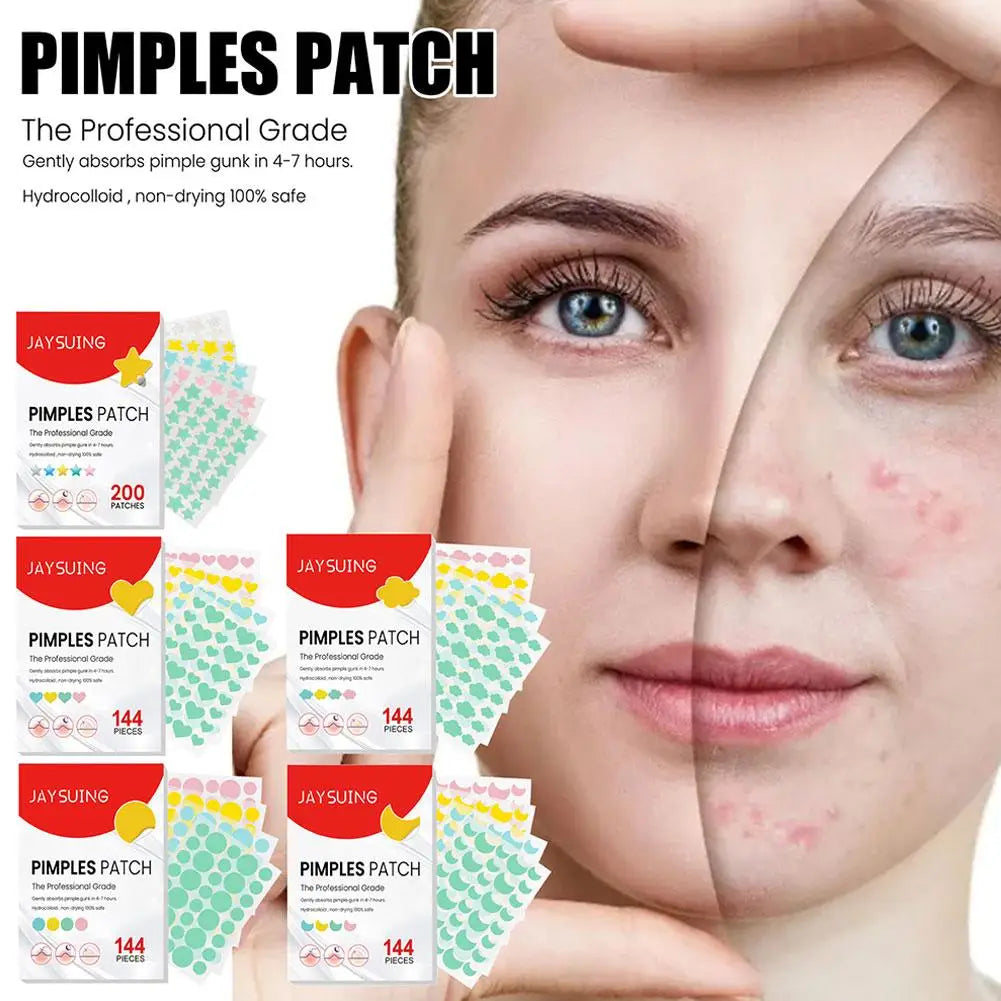 144/200PCS Colorful "Pimple Patches"