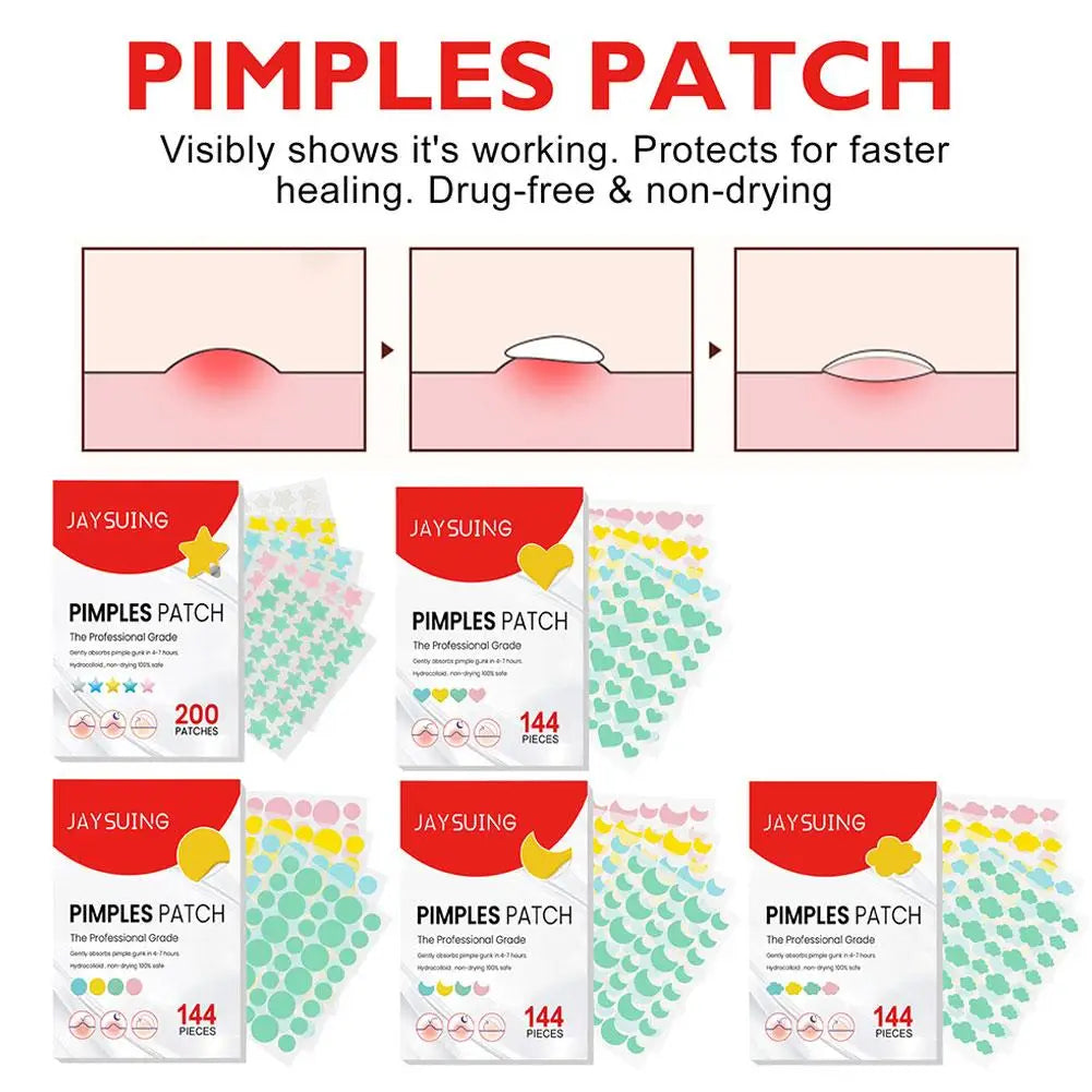 144/200PCS Colorful "Pimple Patches"